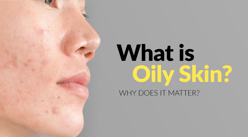 Oily-Skin-_(870x480)